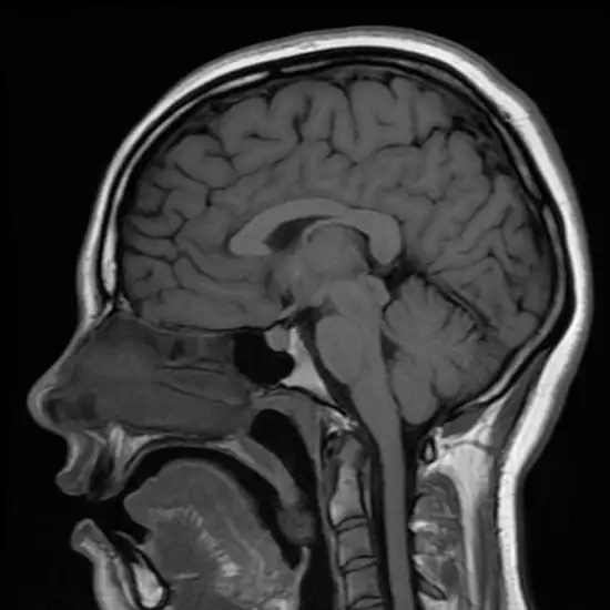 CECT Pituitary Gland Axial or Coronal